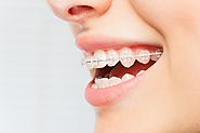 Benefits Of Dental Restoration Facility Services