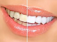 What Are The Benefits Of Visiting Cosmetic Dentist?