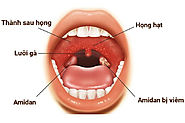 Bệnh viêm họng hạt có nguy hiểm không?