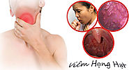 Viêm họng hạt mãn tính và cách điều trị hiệu quả dứt điểm