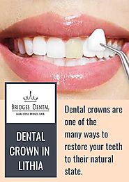 Best Procedure of Dental Crown in Lithia | Bridges Dental