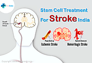 Stem Cell Stroke Treatment in India: Calling Afghanistan Patients for Quality & Affordable Services