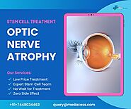 Stem Cell Treatment For Optic Nerve Atrophy Best Way To Treat Your Eye Disease by Med Acess