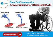 Stem Cell Treatment For Amyotrophic Lateral Sclerosis (als)