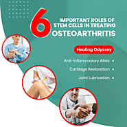 6 Important Roles of Stem Cells in Treating Osteoarthritis: Unraveling the Healing Potential