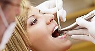Orthodontists Melbourne reveals the worst food items for your oral health