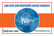 The Benefits of Opting for All-on-4 Dental Implants