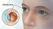 Are you looking best Cataract surgeons in Chicago IL?