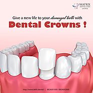 Crowning treatment at Best Dental Clinic at South Delhi - 44530928 - expatriates.com