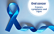 Oral cancer: Causes, symptoms and signs