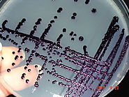 Purple Chromobacterium violaceum rocks!!!