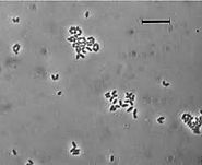 A phase contrast micorgraph image of the bacterium Dietzia natronolimnaea.