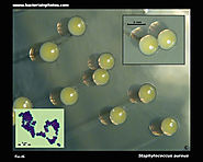 Pigments of Staphylococcus aureus, a series of triterpenoid carotenoids