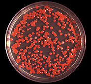 Serratia marcesens colonies as seen on an agar plate with a red pigment