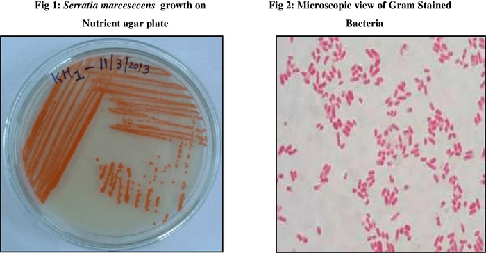 Serratia marcescens | A Listly List