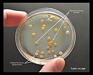 Staphylococcus aureus - My golden child showing off on a soy agar plate