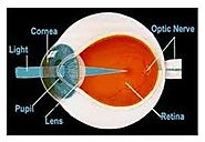 Refractive cataract surgery with Dr. LEO Ayzenberg Best cataract surgery doctor Chicago