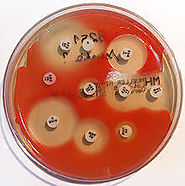 Agar plate indicating Serratia marcescens antibiotic resistance