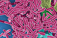 Pseudomonas aeruginosa is a common encapsulated, Gram-negative, rod-shaped bacterium that can cause disease in plants...