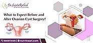 What to Expect Before and After Ovarian Cyst Surgery?