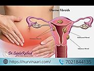 Best Doctor For Fibroid Removal Treatment Thane, Mumbai | Hysterectomy & Myomectomy Specialist Thane