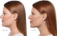 Website at https://www.dynamiclinic.com/cosmetic-surgery/double-chin-removal/