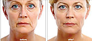 Website at https://www.dynamiclinic.com/cosmetic-surgery/non-surgical-facelift/
