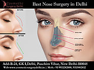 Rhinoplasty Nose Surgery - Best Cosmetic & Plastic Surgery in Delhi, India | Cosmetic Plastic Surgeon in Delhi