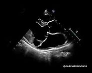 Searchable Point of Care Ultrasound (POCUS) Library on GrepMed