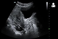 Ultrasound of the Week - learn bedside ultrasound, one week at a time