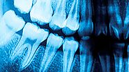 Panoramic Dental X-Ray by King of Prussia Dental™ Associates