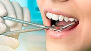 Trust Our Professional General Dentistry Services in King of Prussia, PA