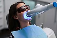 Why Do You Need Professional Teeth Whitening?