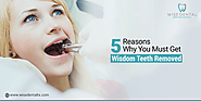 Why You Should Remove Your Wisdom Teeth?