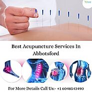 Acupuncture Services In Abbotsford: When To Visit An Acupuncture Clinic?