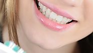How To Whiten Teeth Naturally With Home Remedies | Get Note IT