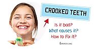 How to Deal with Crooked Teeth the Best Way