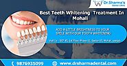 Best Teeth Whitening Treatment in Mohali