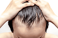 5 Health Benefits Of Hair Vitamins For Men