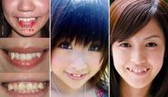Crooked teeth are cute