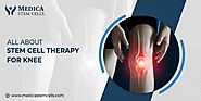 Stem Cell Therapy for Knee, What is it? How Does it Work? & Benefits