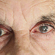 Symptoms of Cataracts - R P G Opticals