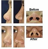 Website at https://www.dynamiclinic.com/cosmetic-surgery/alarplasty/