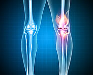 Knee Arthritis Treatment - Osteoarthritis Symptoms, Causes, Advice