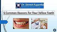 5 Common Reasons for Your Yellow Teeth