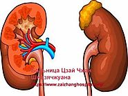 Website at https://www.zaizhanghospital.org/kidney-disease-treatment/190.html