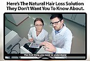 Ultra FX10 Review - Simple Hair Loss Solutions!! | Natural hair loss treatment, Herbs for hair, How to grow natural hair