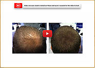 Ultra Fx10 Review - Realistic Way To Activate Your Hair Cells!!