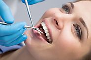 Make your smile more beautiful by teeth cleaning