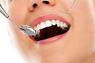 Top 5 Benefits of Cosmetic Dental Bonding Treatment